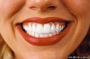 Отбеливание зубов – эффективное решение многих проблем